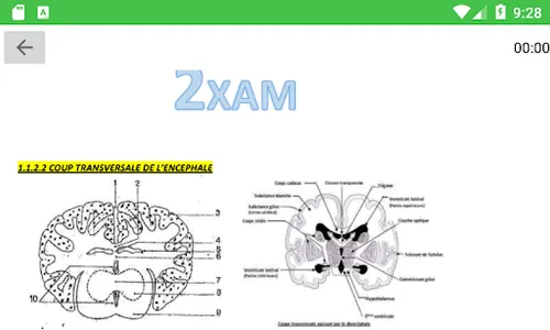 2xam SVT TS2 screenshot 7