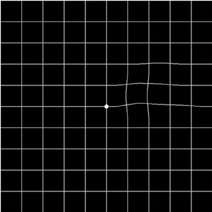 AMD, A Metamorphopsia Detector screenshot 8