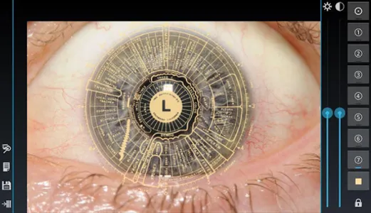 Eye Diagnosis screenshot 5