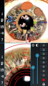 Iridology Unlocker screenshot 0