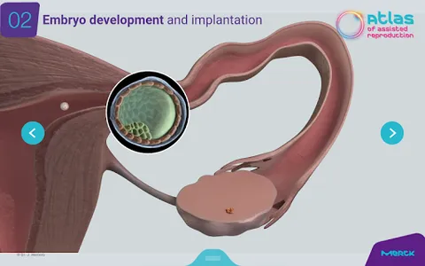ART Atlas - MERCK screenshot 11