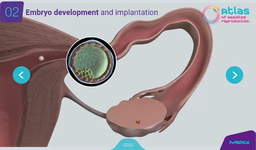 ART Atlas - MERCK screenshot 7
