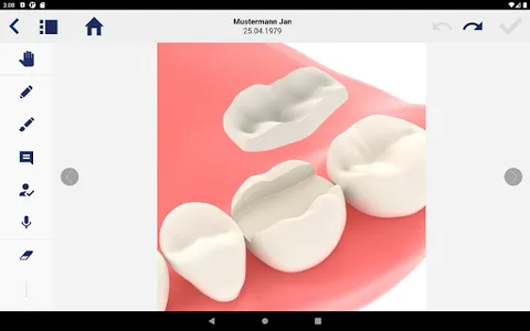 LinuDent Concept screenshot 10