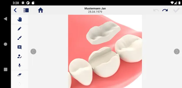 LinuDent Concept screenshot 2