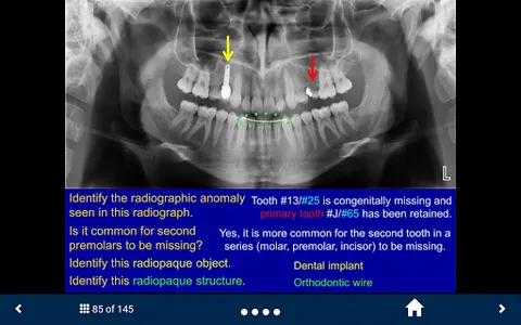 Oral Radiology - SecondLook screenshot 1