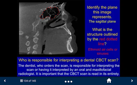 Oral Radiology - SecondLook screenshot 9