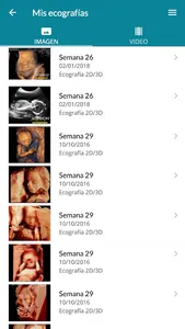 Gynaikos screenshot 2