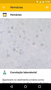Guia de Urinálise screenshot 6