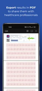 HeartScan: Heart Rate Monitor screenshot 1