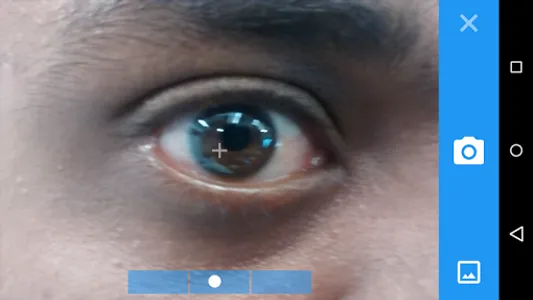 Toric IOL Axis Marker screenshot 2