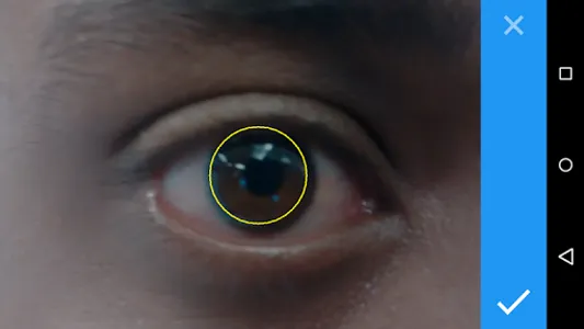Toric IOL Axis Marker screenshot 3