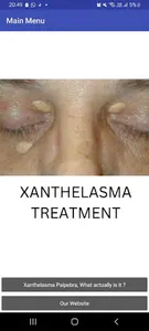 XANTHELASMA TREATMENT screenshot 2