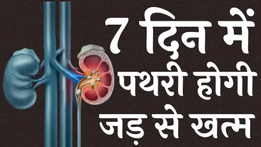 पथरी का घरेलू इलाज - Pathri Ka screenshot 0