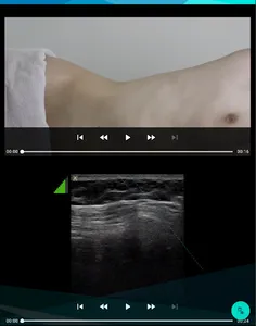 초음파 유도하 침 시술 가이드북 screenshot 14