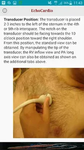 EchoCardio screenshot 2
