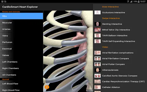 CardioSmart Heart Explorer screenshot 11