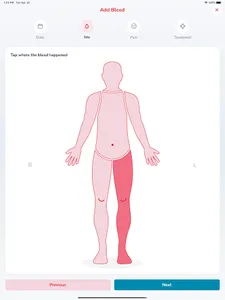 myWBDR screenshot 21