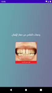 علاج اصفرار الاسنان screenshot 0