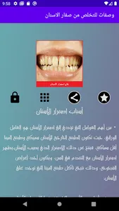 علاج اصفرار الاسنان screenshot 2