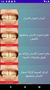 علاج اصفرار الاسنان screenshot 3