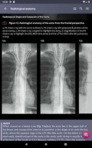 Chest X-Ray DEMO screenshot 13