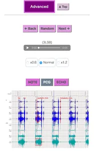 Pocket Heart Sound screenshot 3