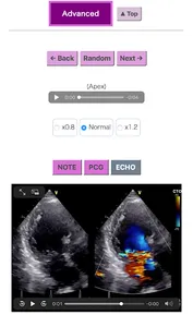 Pocket Heart Sound screenshot 5
