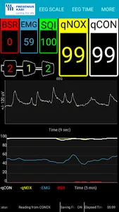 Conox View screenshot 1