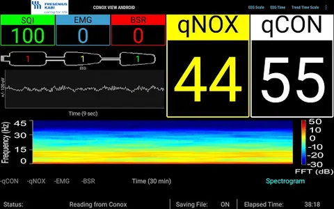 Conox View screenshot 12