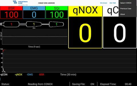 Conox View screenshot 16