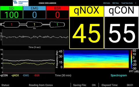 Conox View screenshot 18