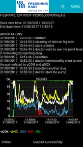 Conox View screenshot 5
