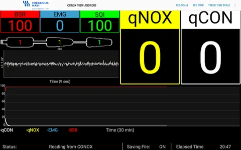 Conox View screenshot 8