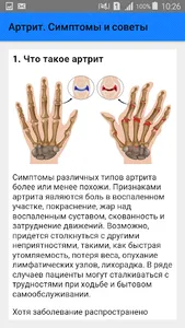 Артрит. Симптомы и советы screenshot 1