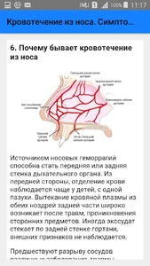 Кровотечение из носа. Симптомы screenshot 5