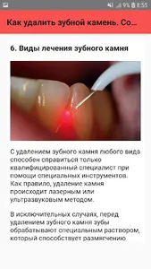 Как удалить зубной камень screenshot 5
