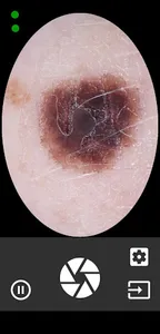 DermaForge VLStream screenshot 0