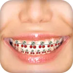 Braces Camera Photo Editor icon