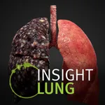 INSIGHT LUNG icon