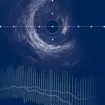 IVUS + Physiology Pro icon