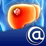 Hepatocellular Carcinoma icon