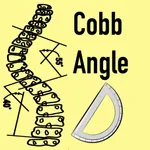 CobbAngleApp icon