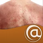 Atopic Dermatitis icon