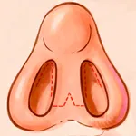 IPO Rinoplastia RA icon