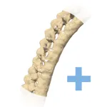 iAnkylosingSpondylitis Pro icon