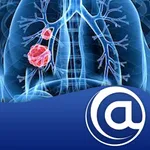 Non-Small Cell Lung Cancer icon