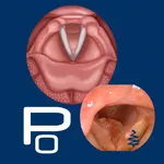 Vocal Pathology: Polyps icon