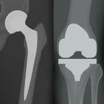 Mi prótesis App icon