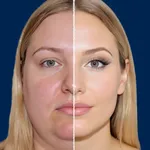 Double Chin Remover icon