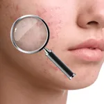 SkinBot - Skin scanner icon